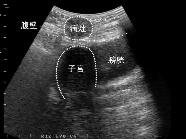 1583391428982084838.png 图片6.png